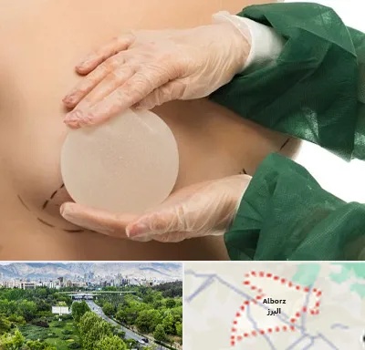 جراحی پروتز سینه در البرز
