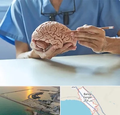 دکتر نورولوژی در بندر کنگان