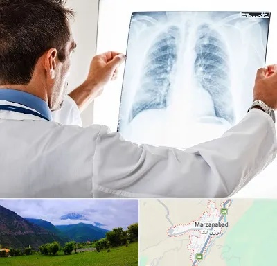 دکتر متخصص ریه در مرزن آباد
