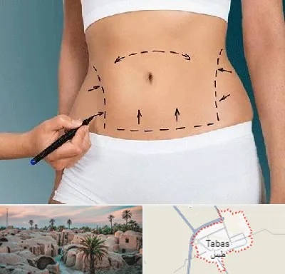 دکتر طب سنتی برای لاغری در طبس