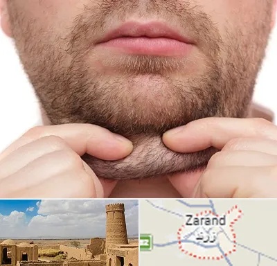 ساکشن غبغب در زرند