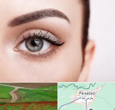 فوق تخصص عنبیه در پارس آباد