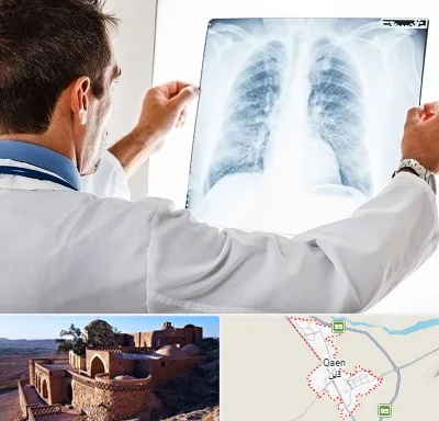 دکتر متخصص ریه در قائن