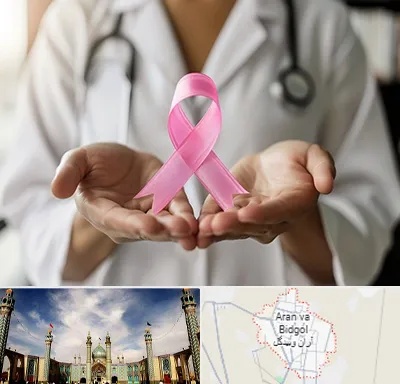 دکتر سرطان پستان در آران و بیدگل