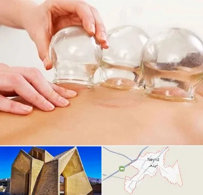 بادکش درمانی در نی ریز