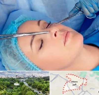 عمل بینی نیمه فانتزی در البرز
