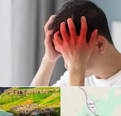 دکتر میگرن در عجب شیر