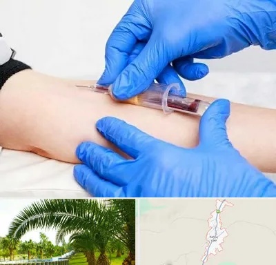 آزمایشگاه ازدواج در کهنوج
