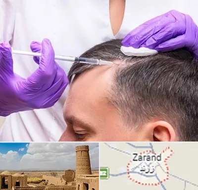 دکتر فوق تخصص پوست و مو در زرند