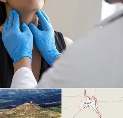 دکتر سرطان گلو در تکاب