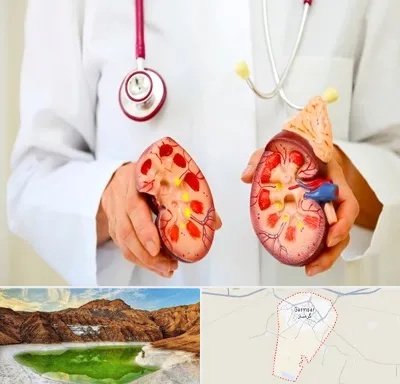 دکتر سنگ کلیه در گرمسار