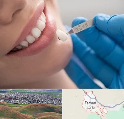 مرکز لمینت دندان در فارسان