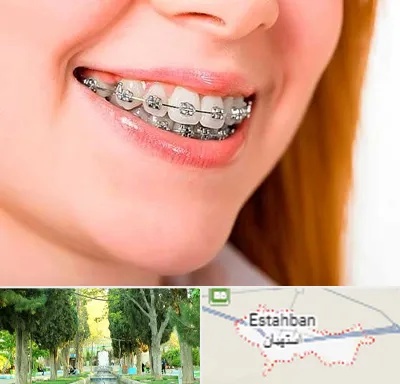 ارتودنسی ارزان در استهبان