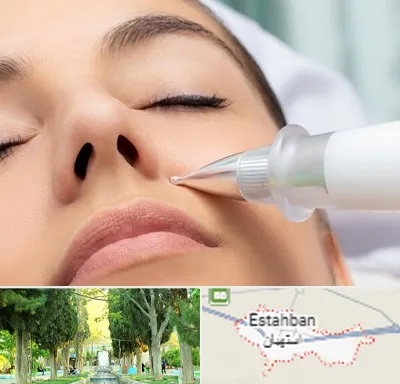 پلاسما جت بینی در استهبان