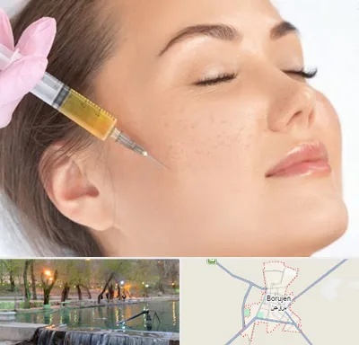 آموزش تزریق ژل و بوتاکس در بروجن