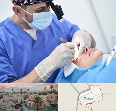 جراح سرطان چشم در طبس