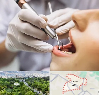 دندانپزشکی ارزان در البرز