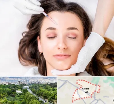 مزوتراپی ابرو در البرز