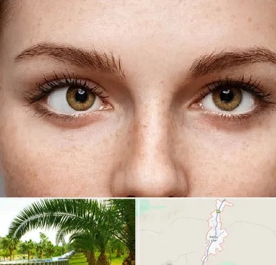 متخصص انحراف چشم در کهنوج