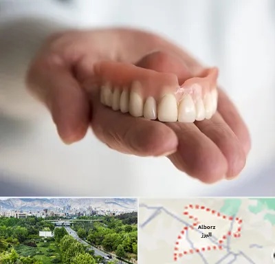 لیفت لثه با لیزر در البرز