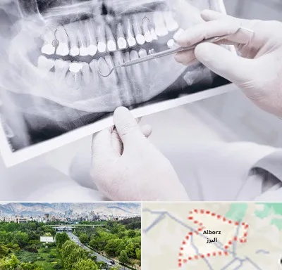رادیولوژی دهان و دندان در البرز