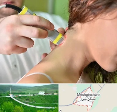 لیزر درمانی در مشگین شهر