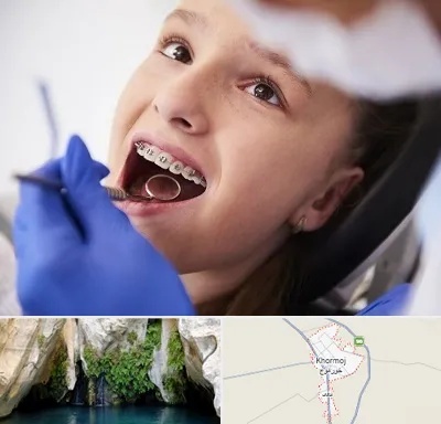 دکتر ارتودنسی کودکان در خورموج