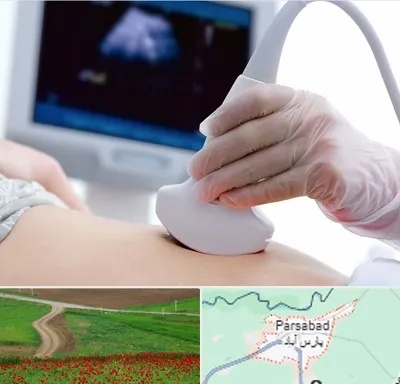 سونوگرافی در پارس آباد