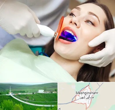 دندانپزشکی بدون درد در مشگین شهر
