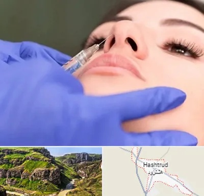 هیالاز در هشترود