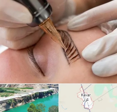 میکروبلیدینگ در کوار