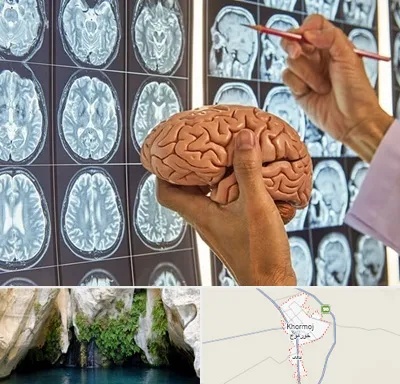 دکتر فوق تخصص جراح مغز و اعصاب در خورموج