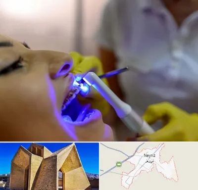دندانپزشکی با لیزر در نی ریز