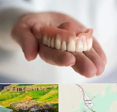 لیفت لثه با لیزر در عجب شیر