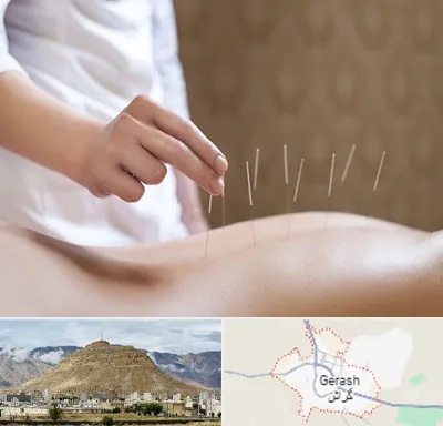 درای نیدلینگ در گراش