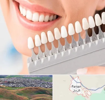 متخصص لمینت دندان در فارسان