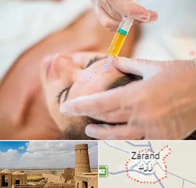 پی آر پی در زرند