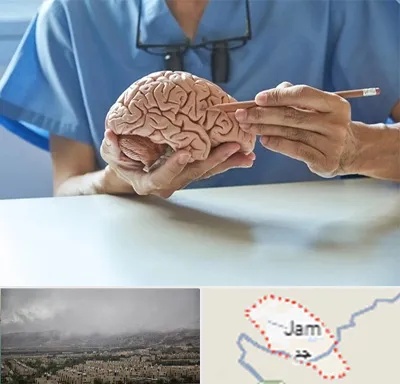 دکتر نورولوژی در جم