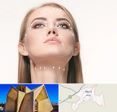 لیفت صورت با نخ در نی ریز