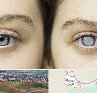 متخصص آب سیاه (گلوکوم) در فارسان