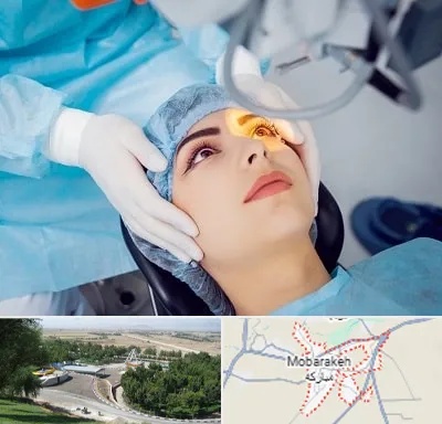 دکتر عمل لیزیک چشم در مبارکه