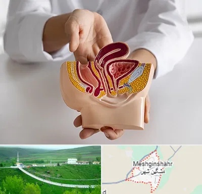دکتر دستگاه تناسلی مردان در مشگین شهر