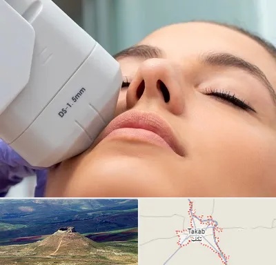 هایفوتراپی در تکاب
