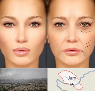 متخصص زیبایی چشم در جم