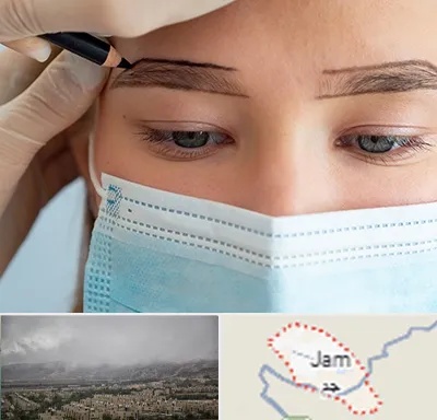 کاشت ابرو در جم
