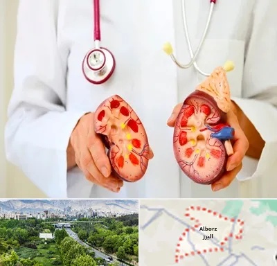 دکتر سنگ کلیه در البرز