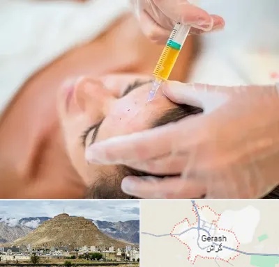 پی آر پی در گراش