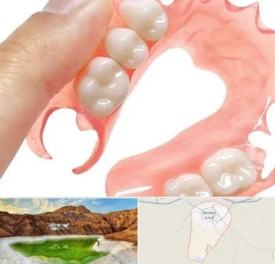 پروتز متحرک دندان در گرمسار