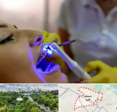 دندانپزشکی با لیزر در البرز