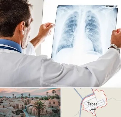 دکتر متخصص ریه در طبس